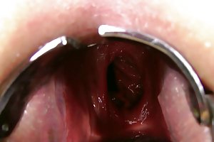 Kinkyniky doble anal fisting prolapso de la xo espéculo gape sexo en el baño video porno
